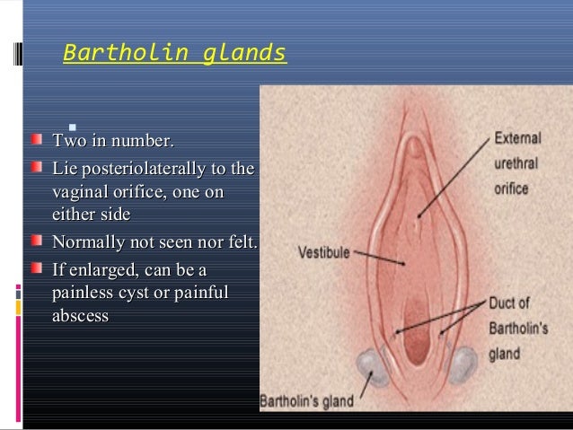 vaginal mucous cyst Vaginal mucous cyst